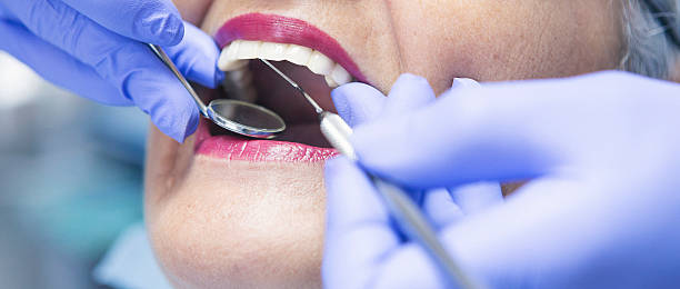 Best Knocked-Out Tooth (Avulsed Tooth) Treatment in Shorewood Hills, WI